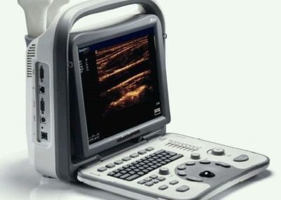 Greeniyv portable Ultra Sound